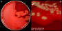 <p><strong>Fig. 103:2.</strong> Kolonier av <i>Fusobacterium necrophorum</i> subsp. <i>necrophorum</i>, stam CCUG 9994, odlad på FAA-platta vid 37 °C under 48 timmar. Observera att denna stam ger hemolys på FAA-plattor till skillnad mot den stam som har använts i Fig. 103:1. Bild A visar hela plattan och bild B en delförstoring. Den totala längden på skalstrecken motsvarar 10 resp. 3 mm. Datum: 2020-11-19.</p>

<p> </p>