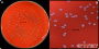 <p><strong>Fig 260:1.</strong> <em>Enterococcus hirae</em>, odlad aerobt på nötblodagar under ett dygn vid 37° C. Bild A visar hela plattan och bild B en delförstoring. Längden på hela skalstrecken i bild A och i bild B motsvarar 10 resp. 3 mm.</p>

<p>Datum: 2023-01-26.</p>