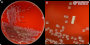 <p><b>Fig. 283:1</b>. Colonies of <i>Frederiksenia canicola</i>, cultivated on bovine blood agar at 37°C during 48 h. Lighting from above during photography. B is a partial close-up of A. The length of the scale bars in A and B corresponds to 1 cm and 5 mm, respectively.</p>