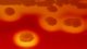 <p><b>Fig. 126:2.</b> Close up of colonies of <i>Dermatophilus congolensis</i>. This figure is left on VetBact for historical reasons. It is the first figure that we included in VetBact (around year 2006).</p>