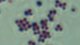 <b>Fig. 23:3.</b>Gram staining of <i>Staphylococcus hyicus</i>. <p>