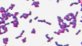 <p>Gram staining of <i>Renibacterium salmoninarum</i>, strain R.s 28/2.</p>

<p> </p>