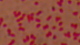 <strong>Fig. 55:3.</strong> Gram staining of <i>Bordetella pertussis</i>.
<p>