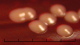 <strong>Fig. 135:2.</strong> Colonies of <i>Staphylococcus pseudintermedius</i>, strain VB 001-09, cultivated aerobically for 24 h. on bovine blood agar at 37°C. The total length of the scale bar is equivalent to 5 mm.
<p>