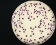 <p><b>Fig. 68:9. </b>Colonies of <i>Escherichia coli</i>, cultivated aerobically on Chromogenic E. coli/coliform selective agar during 24 h at 30°C. This is a medium, which is used for enumeration of coliform bacteria. The medium contains Rose-Gal and X-Glu, which can be used to detect β-galactosidase and β-glucoronidase, respectively. <i>E. coli</i> has both enzymes and gives purple colonies, whereas other coliforms only possess β-galactosidase and, thus, give pink colonies. Other bacteria give coulorless colonies or blue colonies if they have β-glucoronidase. The length of the scale bar is equivalent to 10 mm. Date: 2010-06-17.</p>

<p> </p>