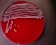 <b>Fig. 20:1.</b> Colonies of <i>Staphylococcus aureus</i> subsp. <i>aureus</i>, strain SLV 350, cultivated aerobically on bovine blood agar during 24 h at 37°C. The lighting was from above and the hemolysis is, therefore, hardly visible (c.f. Fig. 20:3). The length of the scale bar is equivalent to 1 cm. Date: 2011-01-31.<p>