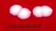 <b>Fig. 20:2.</b> Close up of colonies of <i>Staphylococcus aureus</i> subsp. <i>aureus</i>, strain SLV 350, cultivated aerobically on bovine blood agar during 24 h at 37°C. The lighting was from above and the hemolysis is, therefore, not visible (c.f. Fig. 20:4). The length of the scale bar is equivalent to 5 mm. Date: 2011-02-01.<p>