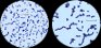 <p><b>Fig. 16:6.</b> Gram staining of <i>Streptococcus agalactiae</i>, strain 09mas018883. Only the degree of magnification differ between the two pictures. The length of the scale bars is in both pictures equivalent to 5 µm. Date: 2011-04-11.</p>

<p> </p>