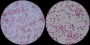 <p><b>Fig. 53:4</b>. Gram staining av <i>Bordetella bronchiseptica</i>, strain xxx. B is a partial close-up of A.</p>

<p> </p>