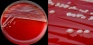 <b>Fig. 53:1</b>. Colonies of <i>Bordetella bronchiseptica</i>, strain xxx, cultivated on bovine blood agar at 37°C during 48 h. Lighting from above during photography. B is a partial close-up of A. The length of the scale bars in A and B corresponds to 10 and 5 mm, respectively.
<p>