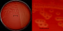 <p><strong>Fig. 16:2.</strong> A. Colonies of <i>Streptococcus agalactiae</i> cultivated, strain VB 0006/11, on bovine blood agar at 37 °C during 24 h. The agar plate was photographed <strong>with light from below</strong>. B. Close-up of some colonies from the agar plate to the left. The clear β-hemolysis can easily be seen in both panels. This strain has a coparatively broad zon of hemolysis. The total length of the scale bars is equivalent to 1 cm and 3 mm, respectively. Date: 2014-11-12.</p>