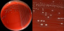 <strong>Fig. 16:1.</strong> A. Colonies of <i>Streptococcus agalactiae</i>, strain VB 0006/11, cultivated on bovine blood agar at 37 °C during 24 h. The agar plate was photographed <strong>with light from above</strong>. B. Close-up of some colonies from the agar plate to the left. The β-hemolysis is difficult to see, but it is more easily observed with light from below (see Fig. 16:2). The total length of the scale bars is equivaleent to 1 cm and 3 mm, respectively. Date: 2014-11-14.</p>