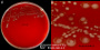 <p><strong>Fig. 26:1.</strong> Colonies of <i>Clostridioides difficile</i>, strain ???, cultivated anaerobically on a FAA plate at 37°C during 48 h. Panel A shows the whole plate and panel B shows a close-up, where the irregular and somewhat diffuse colonies can be observed. The total length of the scale bars are 10 and 5 mm, respectively. Date: 2016-09-08.</p>

<p> </p>
