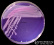 <p><strong>Fig. 86:4.</strong> Colonies of <i>Aeromonas hydrophila</i> subsp. <i>hydrophila</i> cultured on purple agar during 24 h at 37°C. The image shows that this bacterium grows well on purple agar, but it does not ferment lactose (no colour change on the plate. The total length of the scalebar is equivalent to 1 cm. Date: 2016-10-11.</p>

<p> </p>