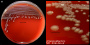 <p><strong>Fig. 71:1.</strong> Colonies of <i>Plesiomonas shigelloides</i> cultivated on bovine blood agar at 37 °C during 24 h. Image B is a close-up of image A. The length of the scale bar is equivalent to 1 cm and 3 mm, respectively. Date: 2016-11-02.</p>

<p> </p>