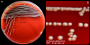 <p><strong>Fig. 87:1.</strong> Colonies of <i>Aeromonas salmonicida</i> subsp. <i>salmonicida</i> cultivated on bovine blood agar at ambient temperature during 48 h. Image B is a close-up of image A. The length of the scale bar is equivalent to 1 cm and 3 mm, respectively. Date: 2016-11-02.</p>

<p> </p>