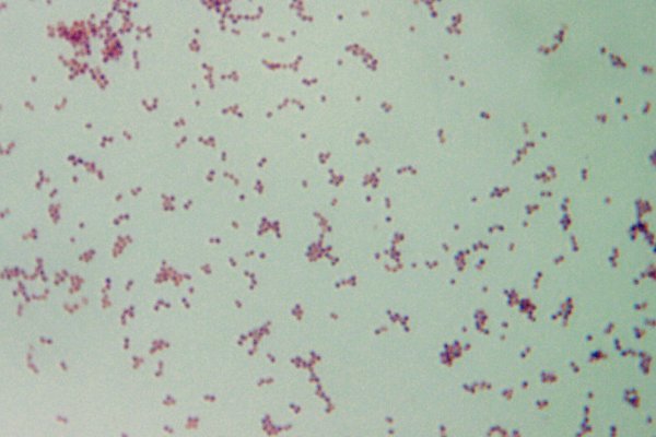 streptococcus-dysgalactiae-subsp-dysgalactiae