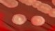 Bacillus cereus