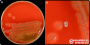 Vibrio cholerae