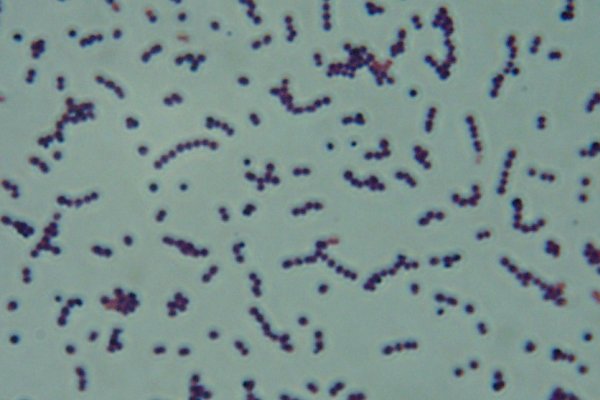 Streptococcus equi subsp. zooepidemicus