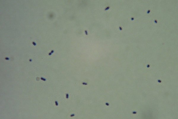 <i>Rhodococcus hoagii</i>