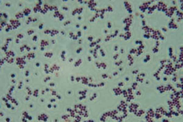 <i>Staphylococcus hyicus</i>.