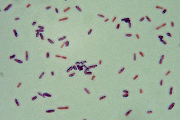 <i>Clostridium perfringens</i>