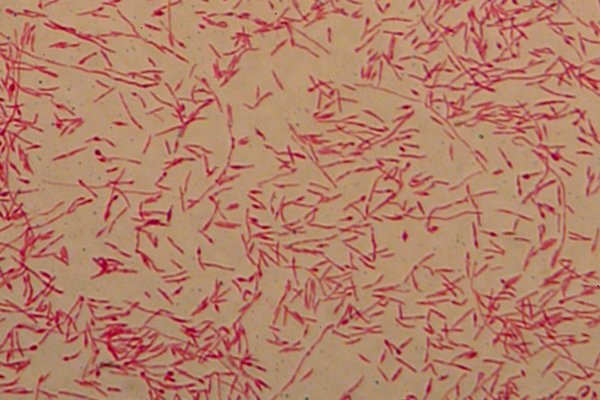 <i>Flavobacterium psychrophilum</i>