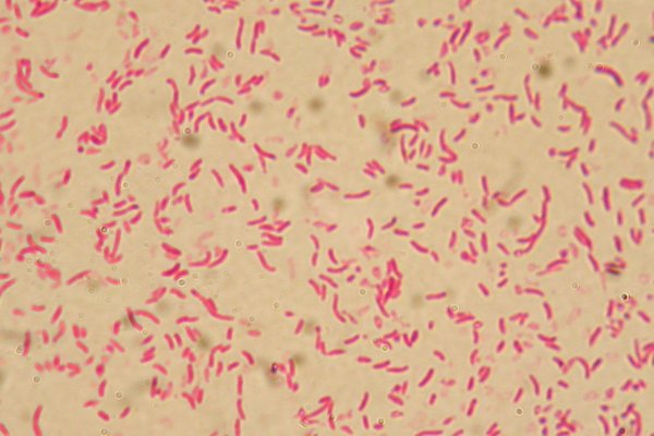 Vibrio Gram Stain