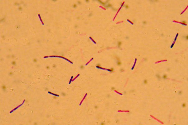 <i>Clostridium botulinum</i>, typ C