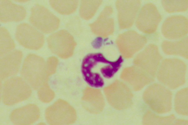 <i>Anaplasma phagocytophilum</i>