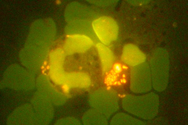 Anaplasma phagocytophilum