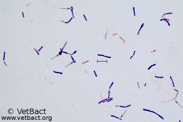 <i>Clostridium tetani</i>