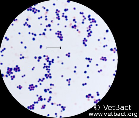<i>Staphylococcus epidermidis</i>