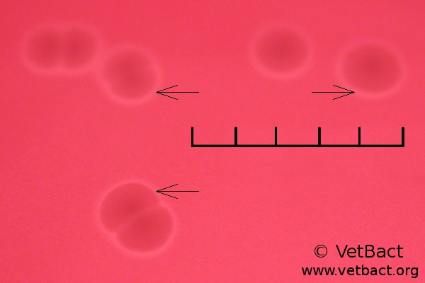 streptococcus-agalactiae