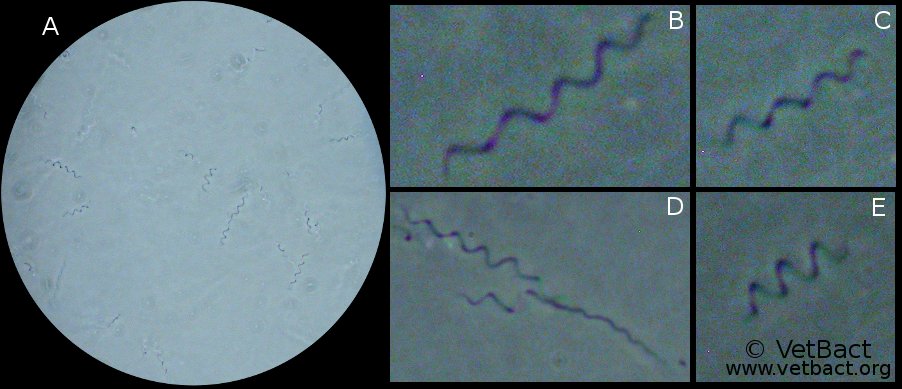 <i>Borrelia burgdorferi</i>