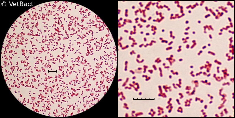 proteus vulgaris gram stain 1000x