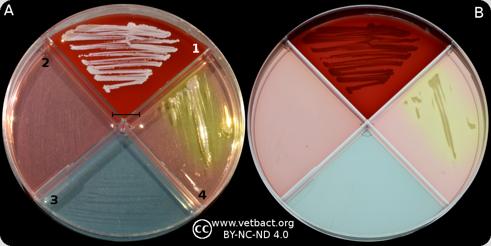 Staphylococcus Saprophyticus