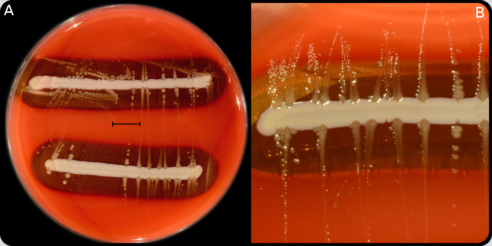 <i>Avibacterium paragallinarum</i>