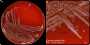 <p><strong>Fig. 287:1.</strong> Close up of colonies of <i>Bacteroides pyogenes </i>cultivated on Fastidious anaerobic agar (FAA-plates)  during 24 h. Image A shows the whole agar plate and image B is a partical close-up. The length of the scale bar is equvalent to 1 cm resp 3 mm. Date: 2026-10-09  </p>