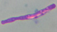 Bacillus anthracis